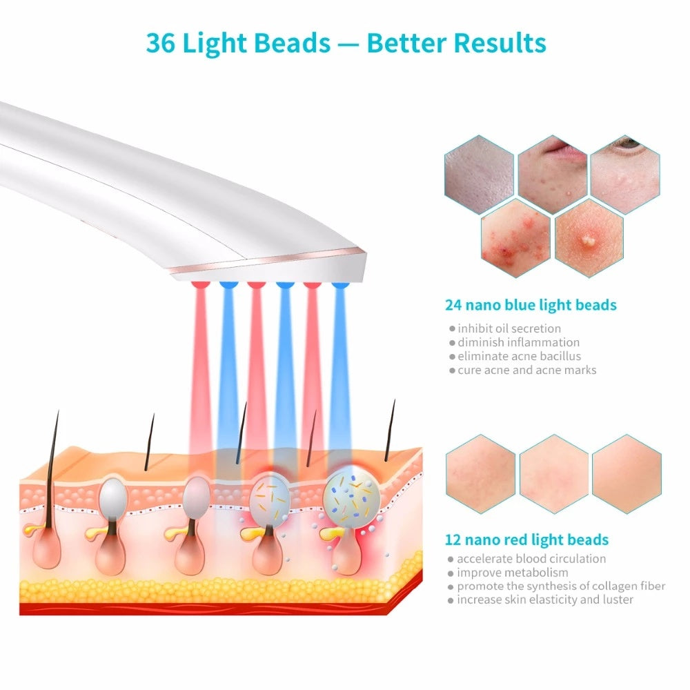 Acne Light Therapy.