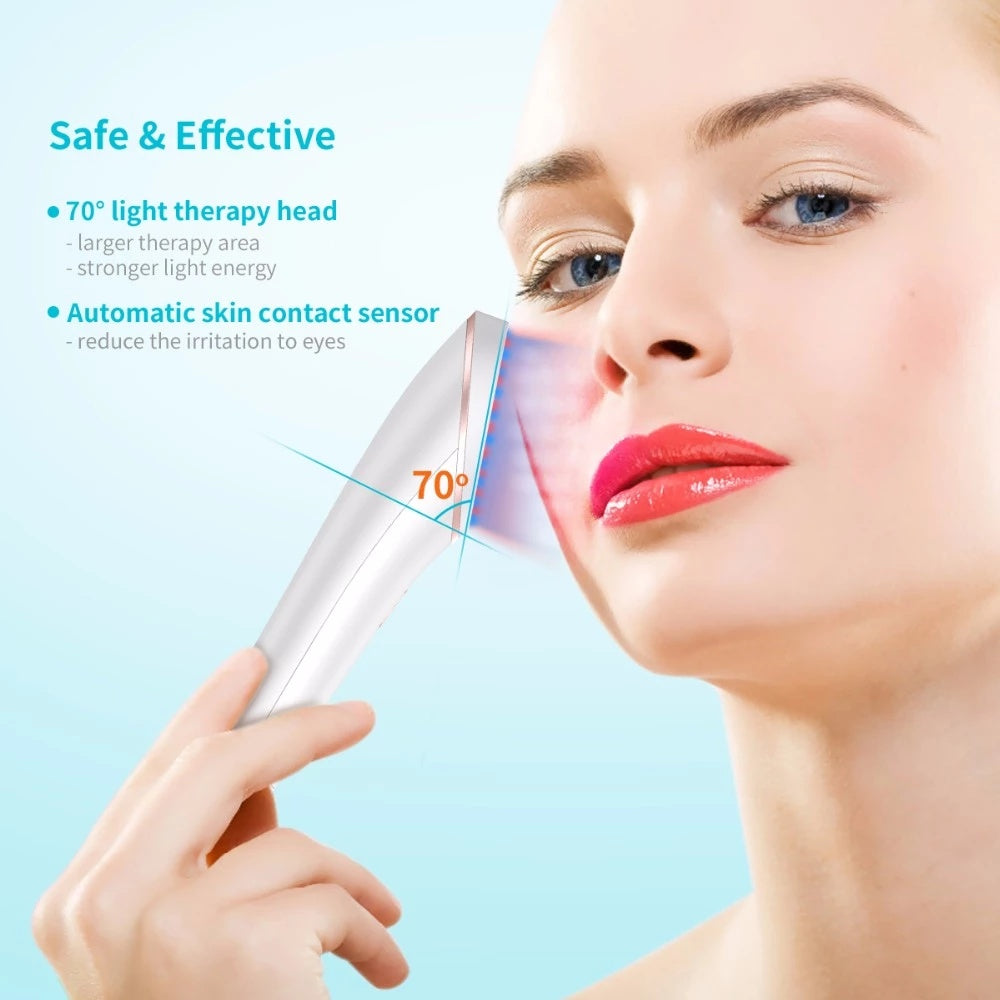 Acne Light Therapy.